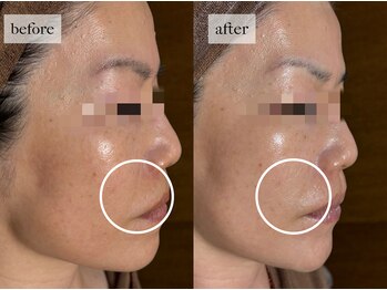 ヒナノ 矢場町店(HINANO)/フォーエバーヤング