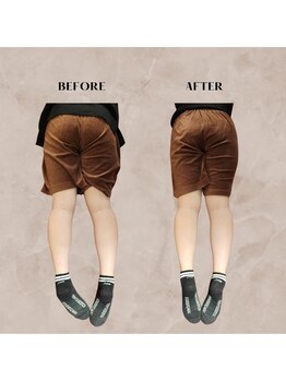 ヴィセル(VISEL)/