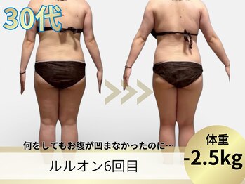 ヨサパーク ア モード ミオ 柴又店(YOSA PARK A modo mio)/何をしてもダメだったお腹凹んだ