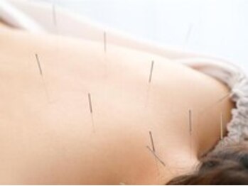 ヘルシースリムウエダ/施術風景【ひばりが丘/鍼灸】