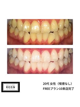 レオン 磐田(REON)/◇ お客様 before＆after ◇