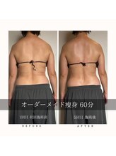 メリア 翠町店(Melia)/スッキリ背中美人に♪