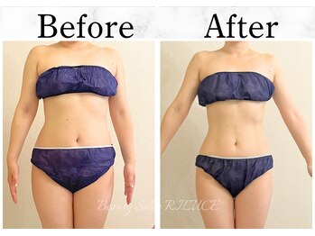 リルチェ 自由が丘(RILUCE)/40代　女性