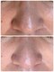 プラス(Plus+)の写真/フェイシャルワックスでうぶ毛も汚れも一掃しお肌の土台を立て直し　浸透を良くします◎