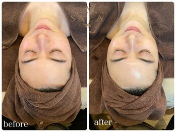サロンドボーテ サラ(salon de beaute SALA)/小顔トリートメント
