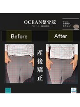 オーシャン整骨院(OCEAN整骨院)/産後矯正の骨盤ビフォーアフター