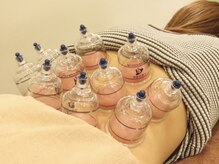 近江あおぞら整骨院の雰囲気（【カッピング】人気のカッピング導入！コリも柔らかく血行促進！）