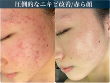 アリィ(Alii hisaya)