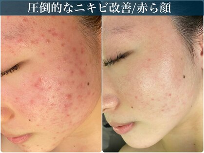 アリィ(Alii hisaya)の写真