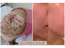 ブルーシー(BLUESEA)の雰囲気（大人気！ハーブピーリング取り扱い店。他フェイシャルメニュー有）