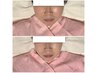 小顔＋体の疲れも取りたい！顔・頭・首・肩・背中＋ハンド＋パック¥12100↓