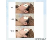 モルティー 広島店(Molti)/ブライダルエステ