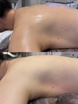 ドクタースタイル(Dr.style)/スッキリ感が違う☆彡