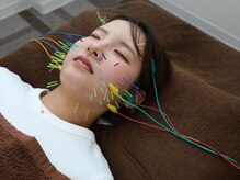 鍼灸整骨院ひで/あなたに合わせた最適の美容鍼