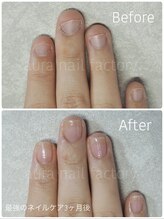 アウラ ネイル ファクトリー(aura nail factory)/最強のネイルケア3ヶ月コース