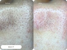 キュレイテッドスキン(CURATED SKIN)/