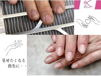 ネイル キシミー(Nail-Kishimi)の写真/当店での深爪・巻爪施術初めての方限定!【お試し¥2,980】〈巻爪〉1本〈深爪〉自爪育成+補強クリア