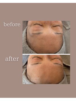 ココロミ(cocoromi)/ダクトピール