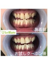 ルブラン 奈良店(Le Blanc)/フリーパススタート！！