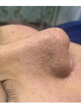 ビューティービューティー(beauty×beauty)