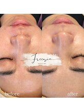 フリージア(Freesia)/鎮静メインの方もご相談ください