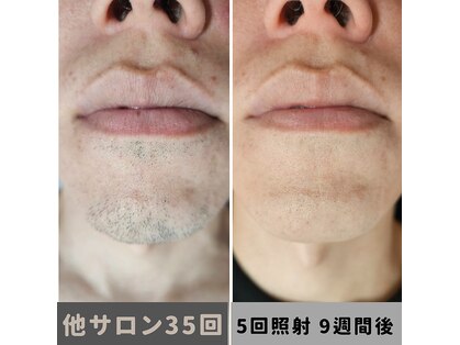 キムラケ 和光別邸(木村家 KIMURAKE)の写真