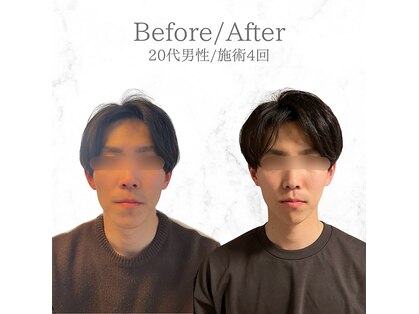 ルーツ 武蔵小杉(R∞ts)の写真