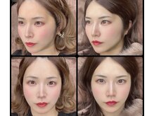 ボディキュア ブライダル美容整体 大阪梅田/【小顔】その場で変化がわかる！