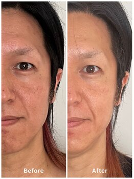 エテル(eter)/フェイシャル　メンズもOK