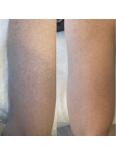 リベル 名古屋(Lebelle:)/ハーブピーリング　名古屋