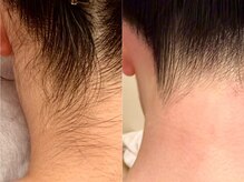 リバース(waxR B S)