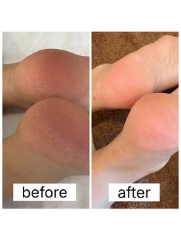 リリー(Rily)/全身マッサージ＋角質ケア