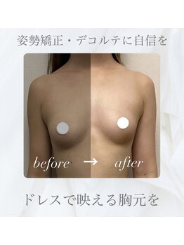 セイ(SEI)/デコルテ美人でブライダルケア