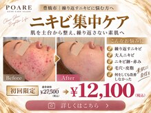ポアレ(POARE)