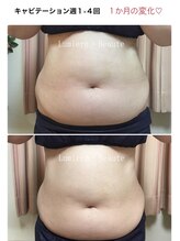 リュミエールボーテ/スリムキャビテーション