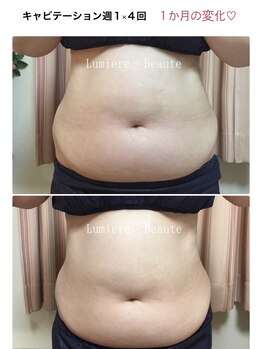 リュミエールボーテ/スリムキャビテーション