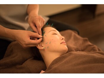 オベロン 銀座(Oberon)/美容鍼