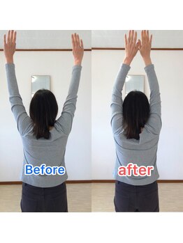 整体サロン佑/整体/beforeAfter