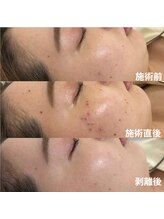 TD 一宮店/★シミケア★ 30分