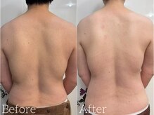 ココロ エステサロン(COCORO)の雰囲気（天然素材の特殊ヘラで解し経絡の巡りを整えます ★シミしわ改善）