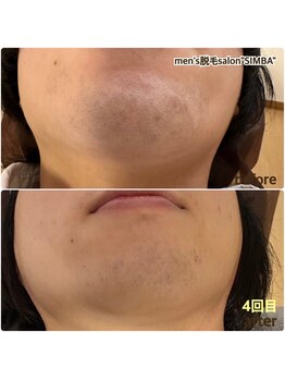 メンズ シンバ(SIMBA)/◯before→after◯
