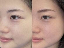 ハリウッドブロウリフト ワクシー 新宿店(HOLLYWOOD BROW LIFT WAXYYY.)/ハリウッドブロウリフト