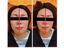 リアルボイス(REAL VOICE)/顎の歪みは全身に影響