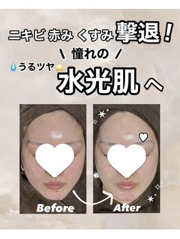 ビレボ マエバシ(BEREVO maebashi)/Before After