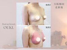 【育乳・バスト専門×女性らしさを磨く】OUKI. 梅田北新地【3月1日 OPEN（予定）】/バストアップ結果写真