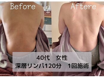 サンライム(Sun Lime)/ビフォーアフター