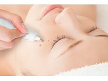 エンボーテ(enbeaute)の雰囲気（低周波シミケアで気になるシミをピンポイントケア）