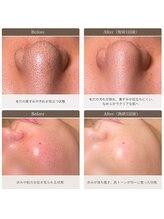 ダイヤモンドサロン限定の特権！ノーファンデへと導く贅沢な高濃度リセラ美容成分を細胞まで届ける。