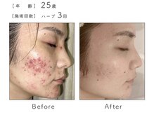 サロン バイオビオ(SALON BioBio)/