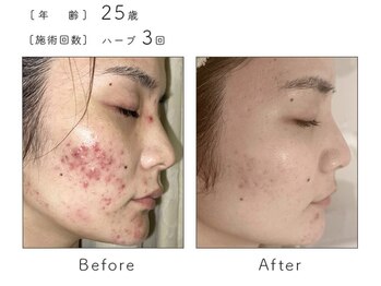 サロン バイオビオ(SALON BioBio)/